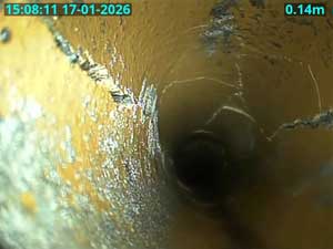 Multiple fractures & broken drain.